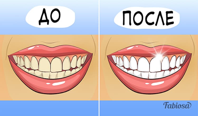 Эти 4 средства с легкостью отбелят ваши зубы. Попробуйте, результат поражает